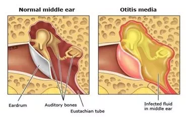 输入图片说明 输入图片说明