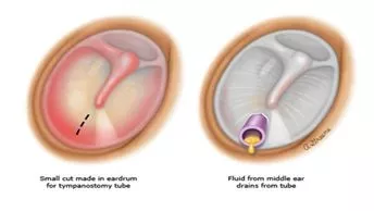 输入图片说明 输入图片说明